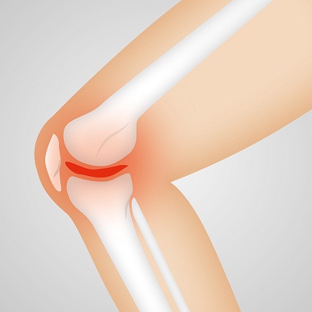 How to Prepare for Knee Surgery